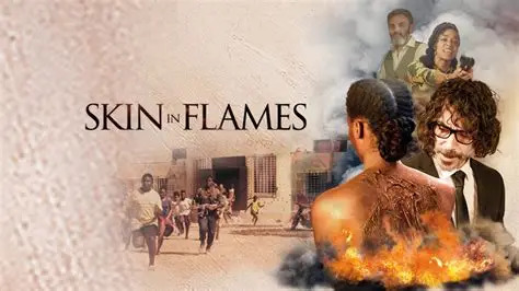 Skin In Flames